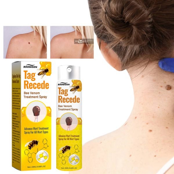 Bee Venom Cures Wart Nursing Spray Cleaning And Desalination